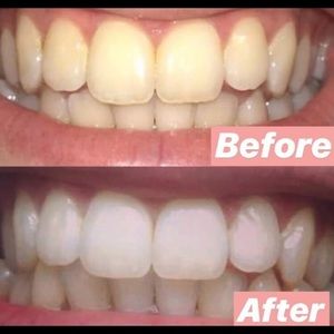 Whitening toothpaste